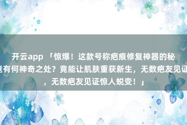 开云app 「惊爆！这款号称疤痕修复神器的秘密武器，究竟有何神奇之处？竟能让肌肤重获新生，无数疤友见证惊人蜕变！」
